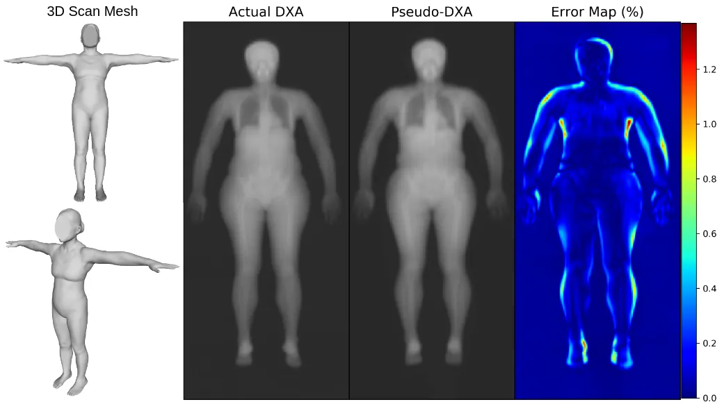 3D scan from the test set, their actual DXA scan, the Pseudo-DXA scan, and error map comparing the actual to the Pseudo-DXA.
