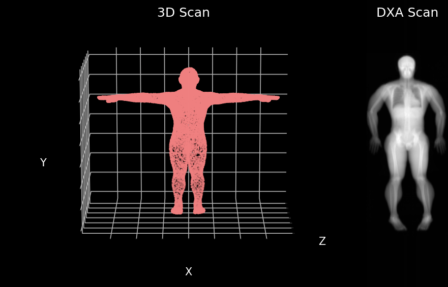 AI Predicts Your Insides From Your Outsides With Pseudo-DXA