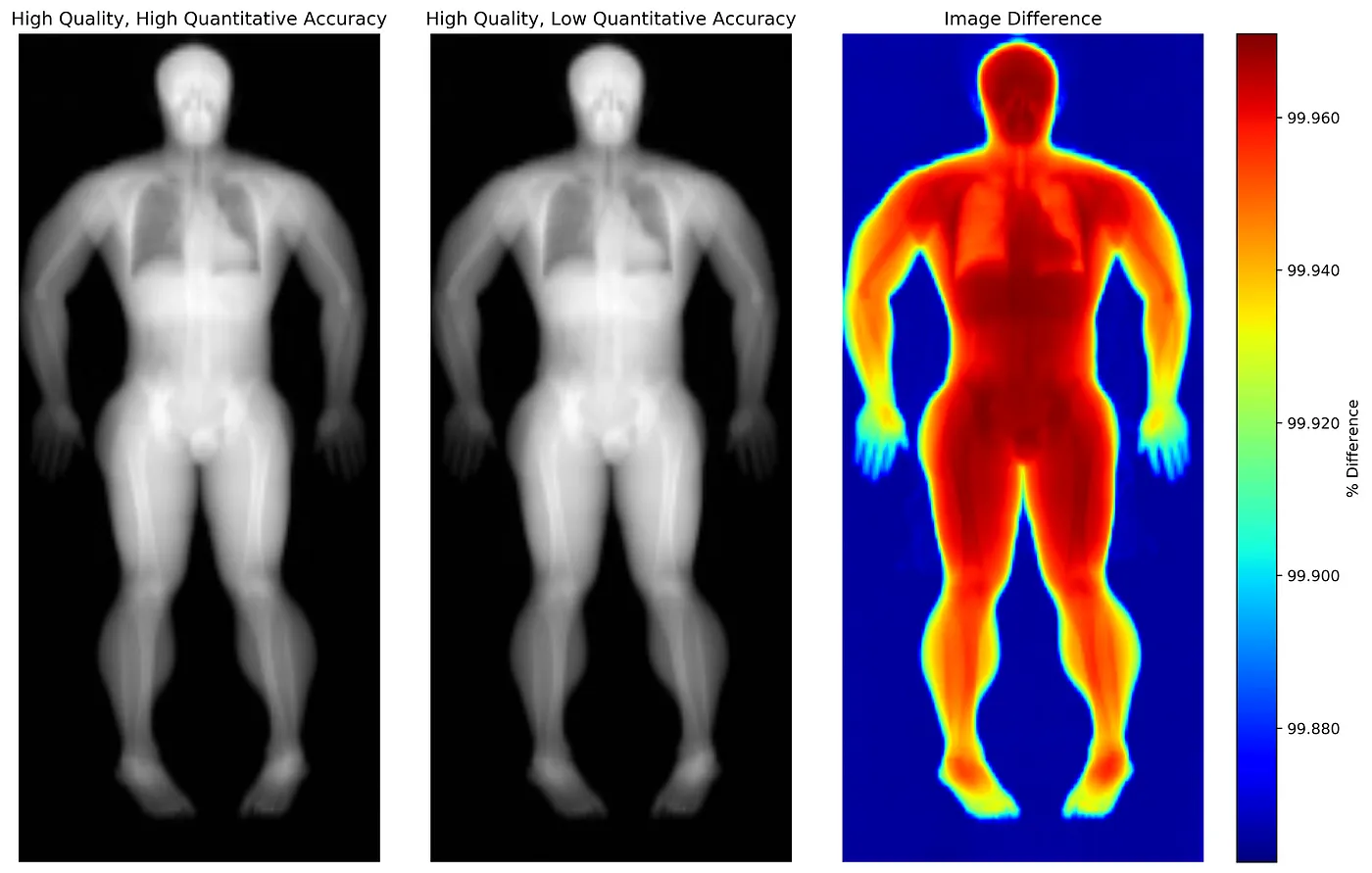 Comparison of medical imaging showing High Quality, High Quantitative Accuracy versus High Quality, Low Quantitative Accuracy, alongside an Image Difference heatmap highlighting discrepancies in measurement details of bone, muscle, and fat across scans.
